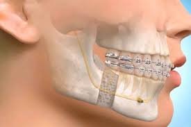 Best Maxillofacial Surgeon in Kanpur