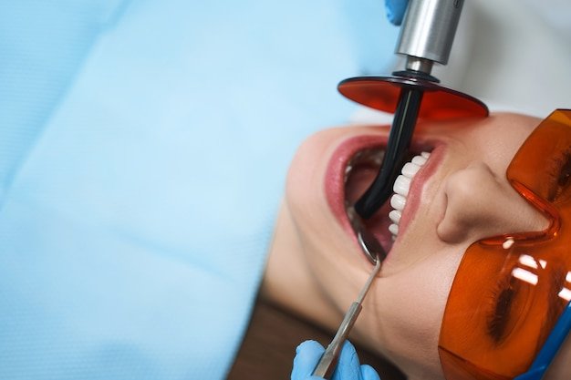 Best Root Canal Treatment in Kanpur