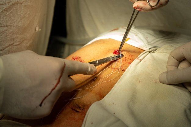 Best Incision Excision Surgery in Kalyanpur