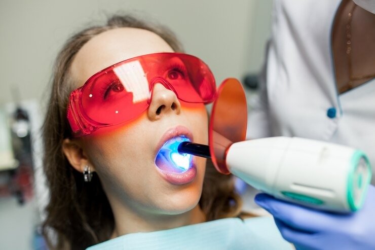 Laser Dentistry Treatment in Kanpur