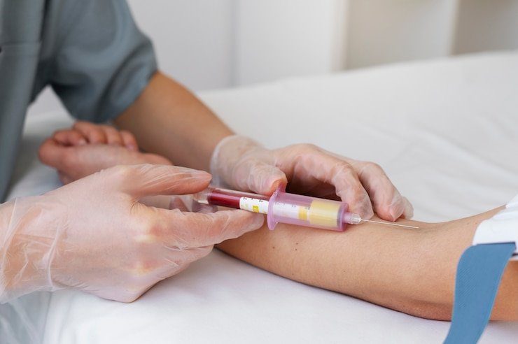 Best Plasma Therapy Centre in Govind Nagar