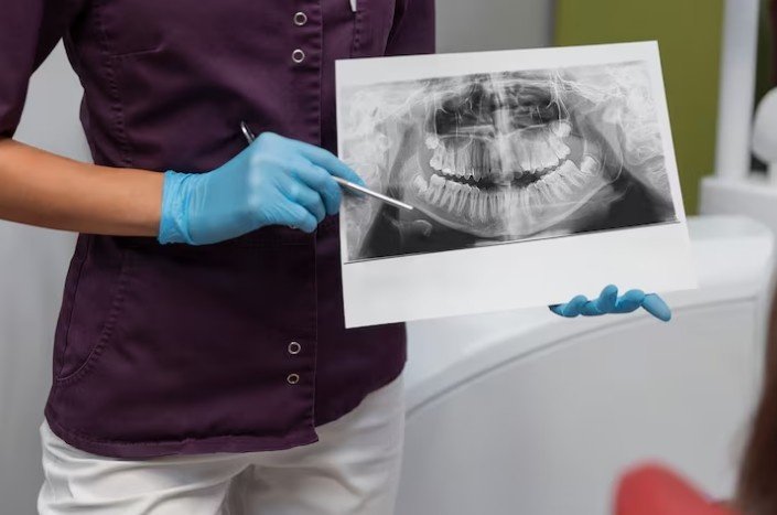 Best Mouth Digital X-ray Service in Kanpur